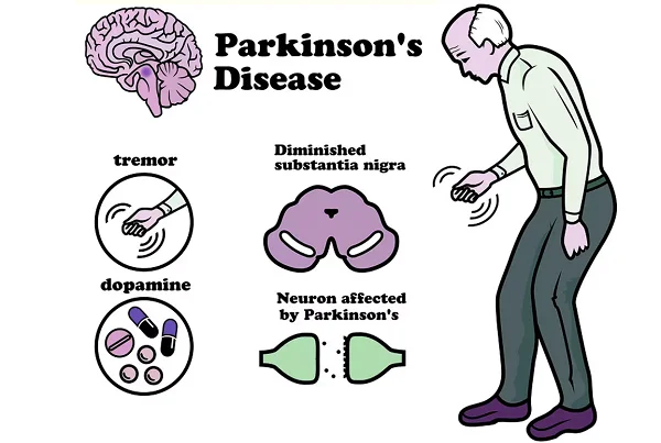 Physiotherapy