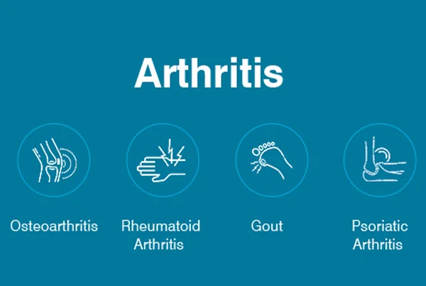 Arthritis / à¤—à¤ à¤¿à¤¯à¤¾