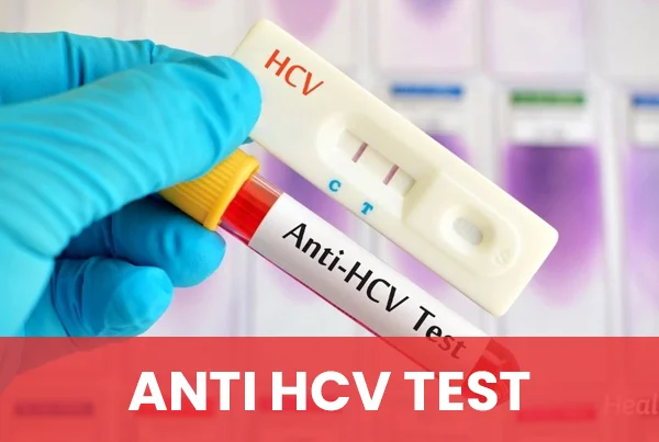 Anti HCV Test