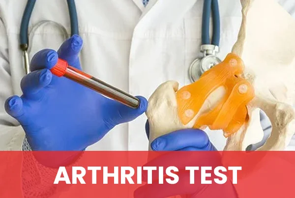 Arthritis Test