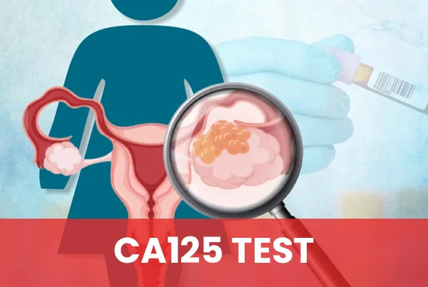 Ca125 Test