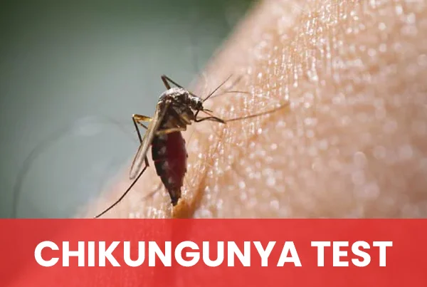Chikungunya Test