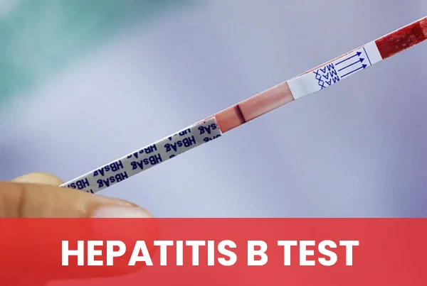 Hepatitis B Test