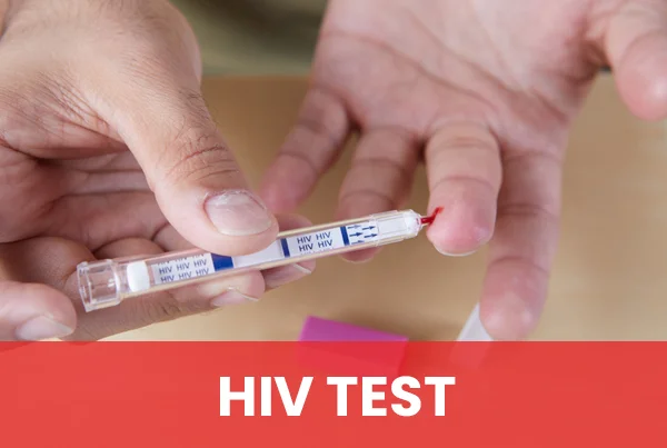 HIV Test