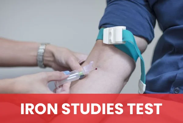 Iron Study Test
