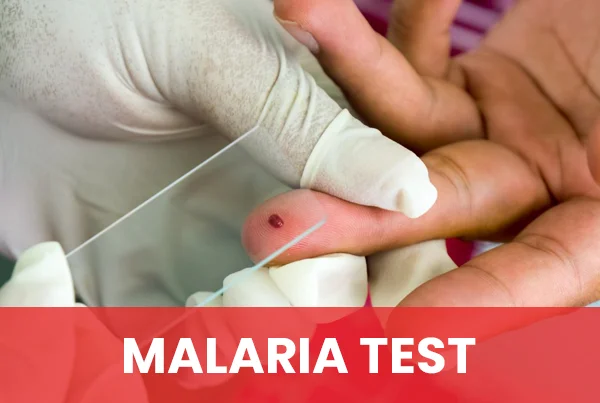 Malaria Test