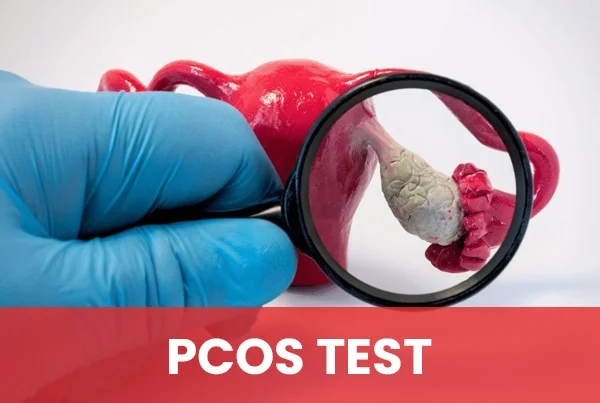 PCOS Test