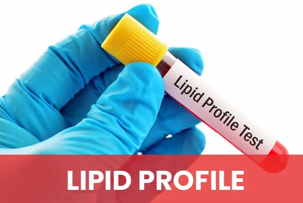 Lipid Profile
